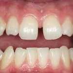 Ortodontia, Ortodontista, Ortodontia Zona Sul, Ortodontia Zona Sul SP, 