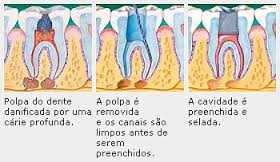 Invisalign Zona Sul SP - Odontologia Apeles Lemos - 5563-5471