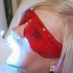Odontologia Estética Zona Sul de SP, Clareamento Dental a Laser Zona Sul SP, Odontologia Estética Zona Sul de SP, Clareamento Dental a Laser Zona Sul SP,