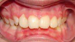 Ortodontia, Ortodontista, Ortodontia na Zona Sul, Ortodontia na Zona Sul SP, Ortodontia na Zona Sul de SP, Ortodontia em SP, Ortodontia em São Paulo