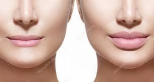 Harmonização Orofacial, Harmonização Orofacial na Zona Sul, Harmonização Orofacial na Zona Sul SP, Harmonização Orofacial em SP, Harmonização Orofacial em São Paulo