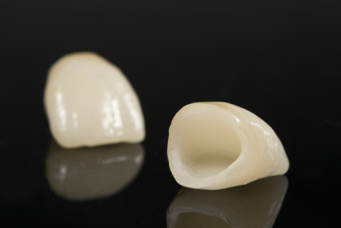 COROAS DENTÁRIAS EM PORCELANA