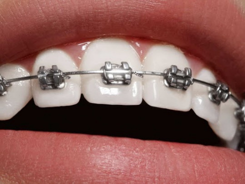 APARELHOS AUTOLIGADOS