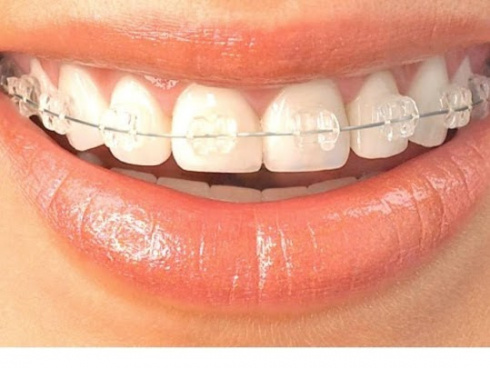 APARELHOS FIXOS ESTÉTICOS ZONA SUL SP