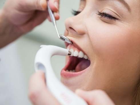 Limpeza Dentária Profissional