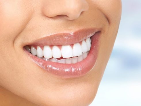 Clareamento Dental Conjugado