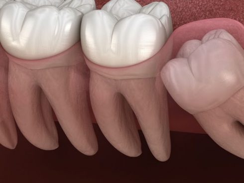 Dentes do Siso Zona Sul SP