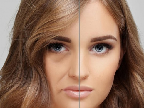 Tratamento do Bigode Chinês